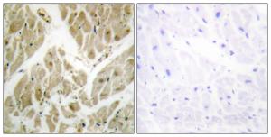 Immunohistochemical analysis of paraffin-embedded human heart tissue using Anti-API-5 Antibody The right hand panel represents a negative control, where the antibody was pre-incubated with the immunising peptide