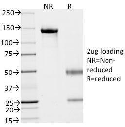 Anti-EpCAM Mouse Monoclonal Antibody [clone: VU-1D9]