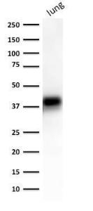 Antibody anti-epcam EGP401372 100 µg