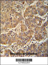 Anti-ATP5D Rabbit Polyclonal Antibody