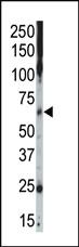 Anti-CSNK1G2 Rabbit Polyclonal Antibody