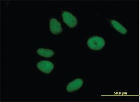 Anti-ZNF43 Mouse Polyclonal Antibody