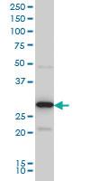 Anti-EXOSC3 Mouse Monoclonal Antibody [clone: 5C3]