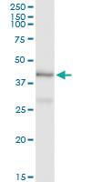 Anti-PCBP2 Antibody Pair