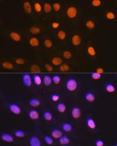 Anti-HMGB2 Rabbit Monoclonal Antibody [clone: ARC1460]