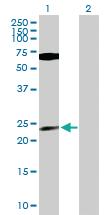 Anti-PPP1CB Mouse Polyclonal Antibody