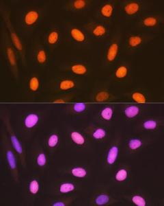 Anti-HMGB2 Rabbit Monoclonal Antibody [clone: ARC1460]