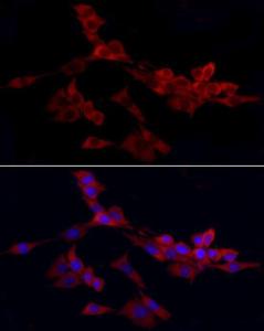 Anti-WIF1 Rabbit Polyclonal Antibody