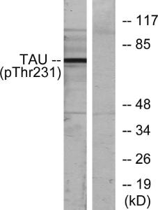 Western blot analysis of lysates from MDA-MB-435 cells using Anti-Tau (phospho Thr231) Antibody. The right hand lane represents a negative control, where the antibody is blocked by the immunising peptide.