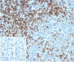 Immunohistochemical analysis of formalin-fixed, paraffin-embedded human tonsil using Anti-CD4 Antibody [CD4/7144] at 2 µg/ml in PBS for 30 minutes at room temperature Inset: PBS instead of the primary antibody Secondary antibody negative control