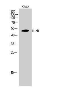 Western blot analysis of K562 cells using Anti-IL-7R Antibody