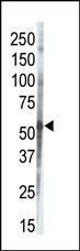 Anti-CSNK1G3 Rabbit Polyclonal Antibody