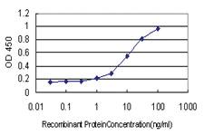 Anti-LAMC1 Mouse Monoclonal Antibody [clone: 2E6-B4]