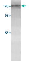 Anti-TOP2B Rabbit Polyclonal Antibody