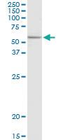 Anti-ELP3 Rabbit Polyclonal Antibody