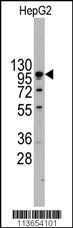 Anti-CDH4 Rabbit Polyclonal Antibody (Biotin)