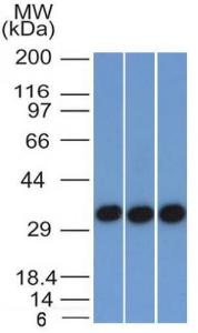 Antibody anti-epcam EGP401372 100 µg