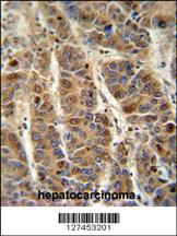 Anti-C4BPA Rabbit Polyclonal Antibody