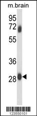 Anti-ARFGAP3 Rabbit Polyclonal Antibody