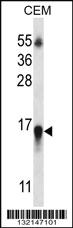 Anti-HIST1H2BN Rabbit Polyclonal Antibody