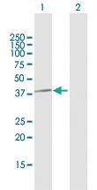 Anti-PPP1CC Mouse Polyclonal Antibody