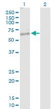 Anti-NKD1 Rabbit Polyclonal Antibody