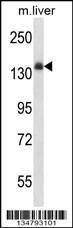 Anti-INSR Rabbit Polyclonal Antibody (APC (Allophycocyanin))