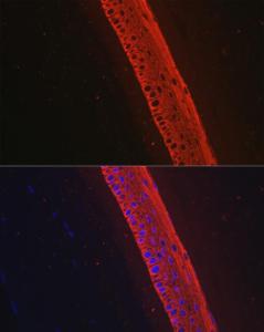 Immunofluorescence analysis of rat eye using Anti-Keratin 12 / K12 Antibody [ARC2465] (A305758) at a dilution of 1:100. DAPI was used to stain the cell nuclei (blue).