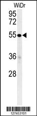 Anti-C4BPA Rabbit Polyclonal Antibody