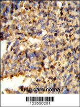 Anti-ARFGAP3 Rabbit Polyclonal Antibody