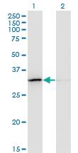 Anti-EXOSC3 Mouse Monoclonal Antibody [clone: 5C3]