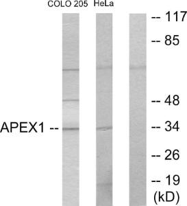 Western blot analysis of lysates from COLO205 and HeLa cells using Anti-APEX1 Antibody. The right hand lane represents a negative control, where the Antibody is blocked by the immunising peptide