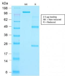 SDS-PAGE analysis of Anti-Thyroglobulin Antibody [r2H11] under non-reduced and reduced conditions; showing intact IgG and intact heavy and light chains, respectively. SDS-PAGE analysis confirms the integrity and purity of the Antibody