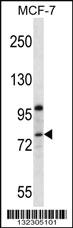 Anti-PPP1R15B Rabbit Polyclonal Antibody