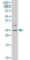 Anti-PPP1R2 Mouse Polyclonal Antibody