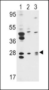 Anti-ELF5 Rabbit Polyclonal Antibody (FITC (Fluorescein))