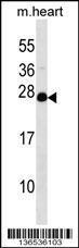 Anti-NUDT4 Rabbit Polyclonal Antibody