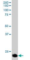 Anti-SOCS3 Goat Polyclonal Antibody