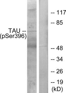 Western blot analysis of lysates from HeLa cells using Anti-Tau (phospho Ser396) Antibody. The right hand lane represents a negative control, where the Antibody is blocked by the immunising peptide