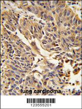 Anti-JUP Rabbit Polyclonal Antibody