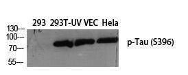 Western blot analysis of various cells using Anti-Tau (phospho Ser396) Antibody