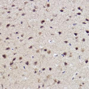 Immunohistochemistry analysis of paraffin-embedded mouse brain using Anti-ALKBH1 Antibody [ARC2511] (A307362) at a dilution of 1:100 (40X lens). Perform high pressure antigen retrieval with 10 mM citrate buffer pH 6.0 before commencing with IHC staining protocol