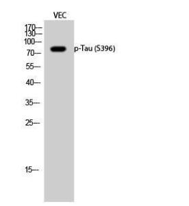 Western blot analysis of VEC cells using Anti-Tau (phospho Ser396) Antibody