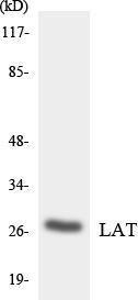 Western blot analysis of the lysates from HUVEC cells using Anti-LAT Antibody