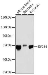 Western blot analysis of extracts of various cell lines, using Anti-eIF2B4 Antibody (A305759) at 1:1,000 dilution. The secondary antibody was Goat Anti-Rabbit IgG H&L Antibody (HRP) at 1:10,000 dilution.