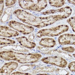 Immunohistochemistry analysis of paraffin-embedded rat kidney using Anti-ALKBH1 Antibody [ARC2511] (A307362) at a dilution of 1:100 (40X lens). Perform high pressure antigen retrieval with 10 mM citrate buffer pH 6.0 before commencing with IHC staining protocol