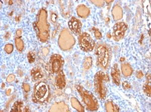 Immunohistochemical analysis of formalin-fixed, paraffin-embedded human thyroid using Anti-Thyroglobulin Antibody [r2H11]