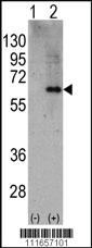 Anti-PRKAA2 Rabbit Polyclonal Antibody