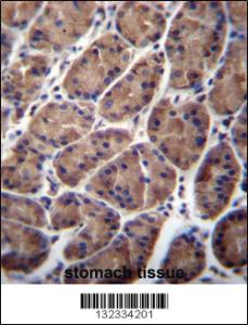 Anti-PFDN5 Rabbit Polyclonal Antibody