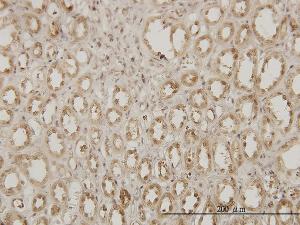 Anti-EXOSC3 Mouse Monoclonal Antibody [clone: 5C3]